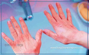 বেশি হাত ধুলে বিপদ,অতিরিক্ত হাত ধোয়ায় যে ক্ষতি, হাত না ধুয়ে কী বিপদ ডেকে আনছেন?, অতিরিক্ত হাত ধোয়ার বিপদ এড়াতে যা করবেন, বারবার হাত ধোয়া দরকার কেন?,অতিরিক্ত হাত ধোয়ায় যে ক্ষতি,