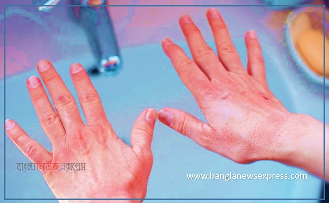Home 14 বেশি হাত ধুলে বিপদ,অতিরিক্ত হাত ধোয়ায় যে ক্ষতি