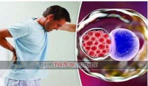 পুরুষের জটিল রোগ ক্লামাইডিয়া