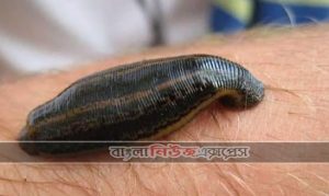 জোঁক এ ধরলে এখন থেকে ভয় পাবেন না