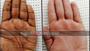 যত্নে যা করণীয়, সারাদিনের কাজে রুক্ষ হাত