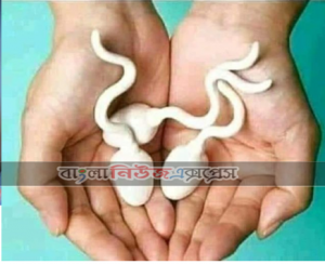 যেভাবে হস্তমৈথুনের জড়িত হয়ে পড়ে একজন ছেলে অথবা মেয়ে| হস্তমৈথুন। পাঠ-৫
