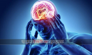 স্ট্রোকের ঝুঁকিতে আমারা
