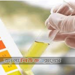 প্রস্রাবের রঙ দেখেও চেনা যায় রোগ