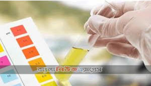 প্রস্রাবের রঙ দেখেও চেনা যায় রোগ
