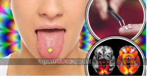 এলএসডি বা লাইসেরজিন এসিড ডাইথ্যালামাইড একটি এসিড বা সিনথেটিক ড্রাগ