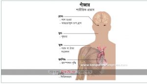 গাঁজা খেলে কী কী ক্ষতি হয়?,গাঁজা খেলে বৃদ্ধি পায় যৌন ক্ষমতা,  গাঁজা খেলে সেরে যায় অনেক রোগ বলছে গবেষনা,গাজা খাওয়ার উপকার এবং অপকার কী কী?,পরিমাণ মতো গাঁজা সেবনে অনেক উপকার