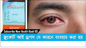 ফ্লুকোর্ট আই ড্রপস যে কারনে ব্যবহার করা হয়, লালচে চোখের জন্য ফ্লুকোর্ট আই ড্রপস,চোখ জালা ফ্লুকোর্ট চোখের ড্রপস,চোখে অ্যালার্জি বা চুলকানি হবার কারণ ও প্রতিকার,চোখ জ্বালাপোড়া ফ্লুকোর্ট চোখের ড্রপস