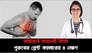 পুরুষের ব্রেস্ট ক্যান্সারের লক্ষণ, পুরুষের স্তন ক্যান্সার কীভাবে বুঝবেন? , অবহেলা করলেই বিপদ পুরুষের ব্রেস্ট ক্যান্সারের ৪ লক্ষণ