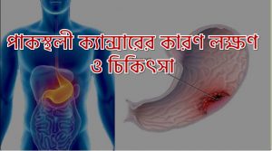 সপ্তাহে কতবার সহবাস সন্তান ধারণের জন্য উপযোগী?, সপ্তাহে কতবার যৌন মিলন সম্পর্ক গভীর করে? 3 পাকস্থলী ক্যান্সারের কারণ লক্ষণ ও চিকিৎসা, পাকস্থলীর ক্যান্সারের লক্ষণ ও প্রতিকার, যেসব লক্ষণে বুঝবেন পাকস্থলীর ক্যান্সার কী করবেন?