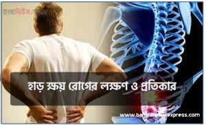 হাড় ক্ষয় রোগের লক্ষণ ও প্রতিকার, হাড় ক্ষয় রোগের চিকিৎসা