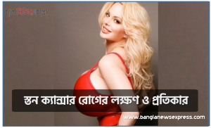 স্তন ক্যান্সার রোগের লক্ষণ ও প্রতিকার, স্তন ক্যান্সার রোগের চিকিৎসা