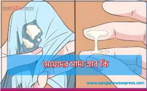 মেয়েদের সাদা স্রাব কি, সাদা স্রাব কেন হয়, সাদা স্রাব চিকিৎসা, কখন যোনি স্রাব নিয়ে চিন্তিত হবেন?