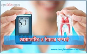 ডায়াবেটিস ও দাঁতের সম্পর্ক, ডায়াবেটিস রোগীর দাঁত ও মাড়ির সমস্যা, ডায়াবেটিসে দাঁতের রোগের ঝুঁকি বাড়ে