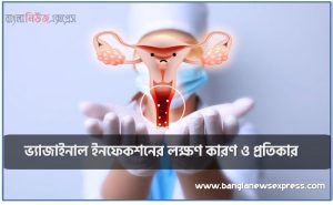 ভ্যাজাইনাল ইচিনেস, ভ্যাজাইনাল ইনফেকশনের লক্ষণ কারণ ও প্রতিকার