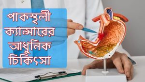 পাকস্থলীর ক্যান্সার, পাকস্থলী ক্যান্সারের আধুনিক চিকিৎসা,পাকস্থলীর ক্যানসার প্রতিরোধের উপায়