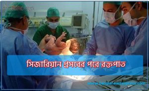 সিজারিয়ান প্রসবের পরে রক্তপাত,সিজারের পর কতদিন ব্লিডিং হয়, সিজারিয়ান প্রসবের পরে রক্তপাত