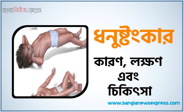 ধনুষ্টংকার কারণ লক্ষণ ও চিকিৎসা, ধনুষ্টংকার লক্ষণ ও প্রতিকার,ধনুষ্টংকার লক্ষণ ও প্রতিকার, ধনুষ্টংকার কেন হয়? লক্ষণ ও চিকিৎসা কি?, ধনুষ্টংকার লক্ষণ ও চিকিৎসা