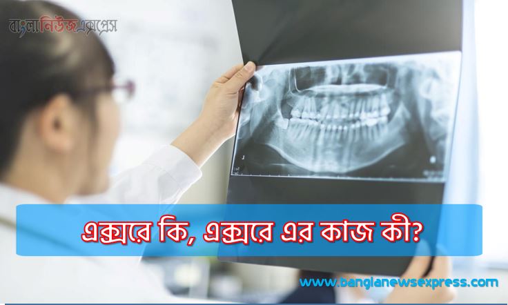এক্সরে কি, এক্সরে এর কাজ কী?,এক্সরে কি ধরনের প্রযুক্তি?, এক্সরে ব্যবহার,এক্সরে ভালো খারাপ ‍দিক,এক্সরে কেন গুরুত্বপূর্ণ?,এক্সরে ব্যবহার সতর্কতা,এক্স-রে থেরাপি এবং এর প্রভাব সম্পর্কে জানতে চাই,এক্সরে করার সময় কোন কোন বিষয়গুলির প্রতি সতর্ক থাকতে হবে?,
