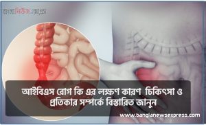 আইবিএস রোগ কি এর লক্ষণ কারণ চিকিৎসা ও প্রতিকার সম্পর্কে বিস্তারিত জানুন 3 আইবিএস রোগ কি এর লক্ষণ কারণ চিকিৎসা ও প্রতিকার সম্পর্কে বিস্তারিত জানুন
