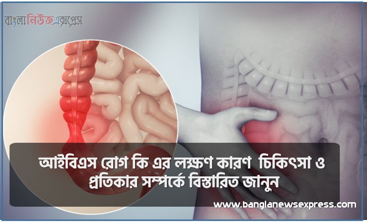 আইবিএস রোগ কি এর লক্ষণ কারণ চিকিৎসা ও প্রতিকার সম্পর্কে বিস্তারিত জানুন