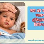 হাম এর কারণ লক্ষণ প্রতিরোধ ও চিকিৎসা 9 হাম এর কারণ লক্ষণ প্রতিরোধ ও চিকিৎসা, হাম রোগের প্রধান চিকিৎসা কি?, হাম প্রতিকারের উপায় কী?,মানুষের হাম রোগের চিকিৎসা কী?,হাম প্রতিরোধের উপায়?