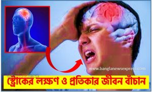স্ট্রোকের লক্ষণ ও প্রতিকার সময়মতো চিনুন জীবন বাঁচান, Stroke এর প্রাথমিক লক্ষণ কী?,স্ট্রোক হওয়ার আগে কি কি লক্ষণ দেখা যায়?