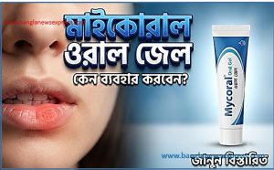 মাইকোরাল ওরাল জেল (Mycoral Oral Gel) কেন ব্যবহার করবেন? বিস্তারিত জানুন। 2 মাইকোরাল ওরাল জেল (Mycoral Oral Gel) কেন ব্যবহার করবেন? বিস্তারিত জানুন।,মুখের ঘা ও ছত্রাক সংক্রমণে মাইকোরাল ওরাল জেল: সঠিক ব্যবহারের নিয়ম।,মাইকোরাল ওরাল জেল,